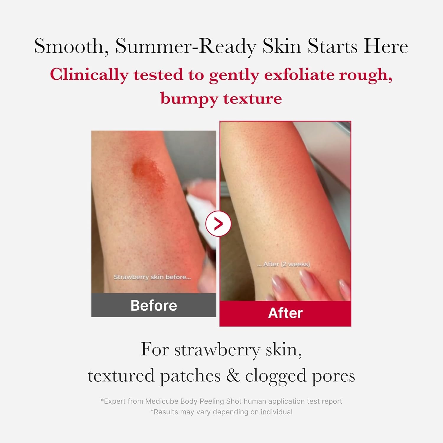 Medicube Red Body Peeling Shot 110g Korean Skin Care Body Care Products AHA + BHA Exfoliating Body Spray Pore Care