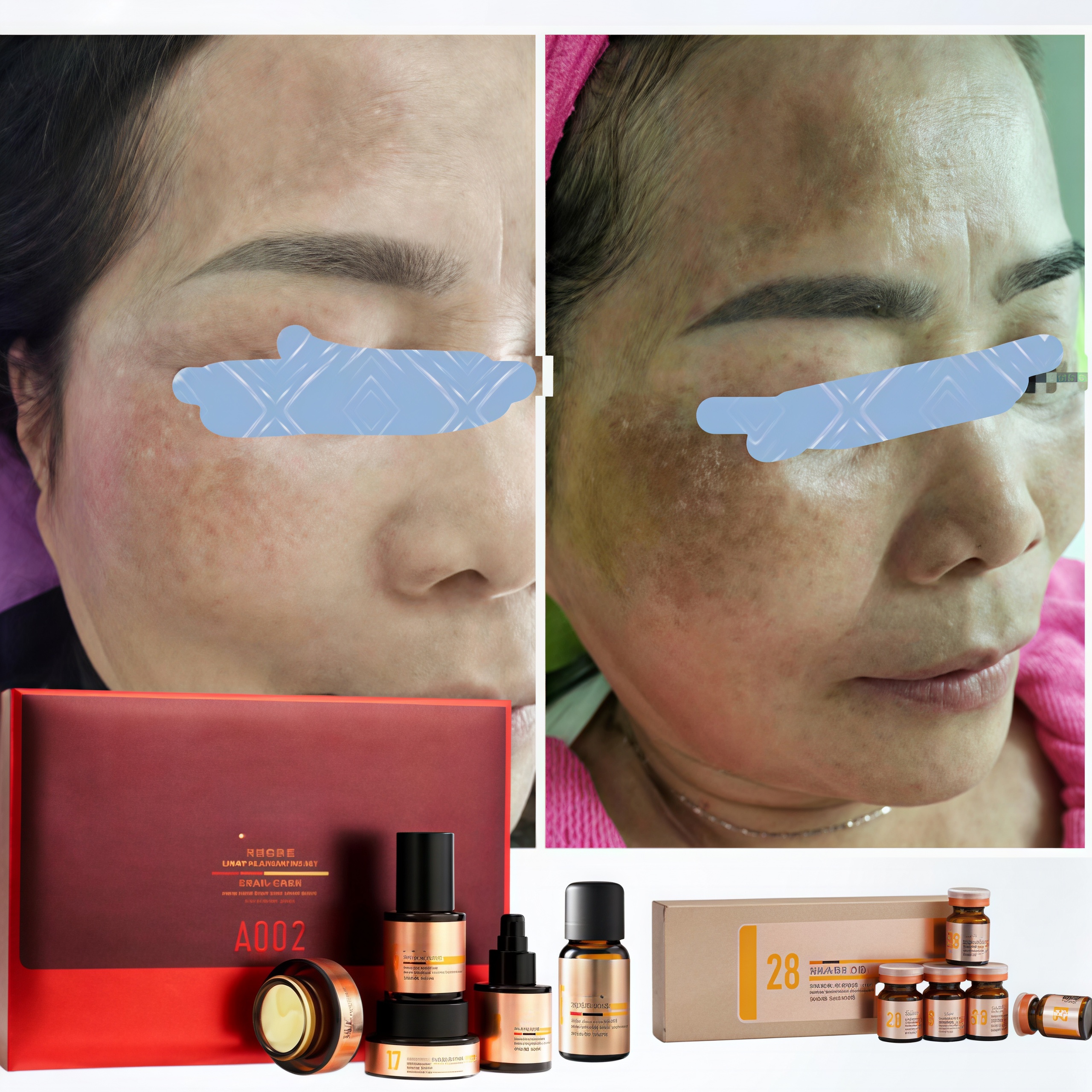 OEM Professional Stubborn Dermal Spot Fading Kit Deep Melasma Hyperpigmentation Peel Correction Remove Even Skin Tone Facial Set