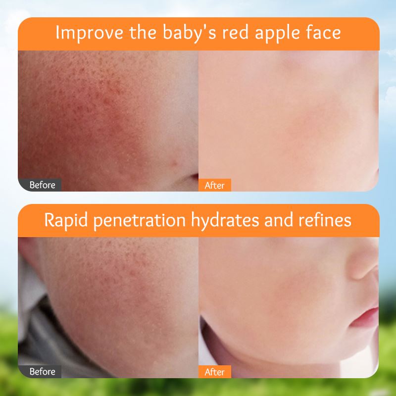 OEM SADOER Kids Moisturizer Cream Organic Calendula Gentle Hydrating Skin Care Sensitive Soothing Repair Baby Face Beauty Cream