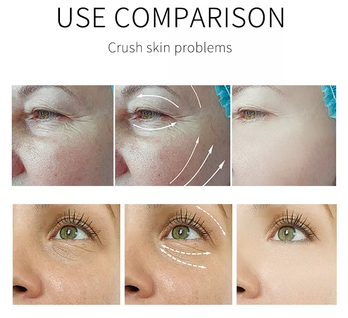 Using Effect Comparison