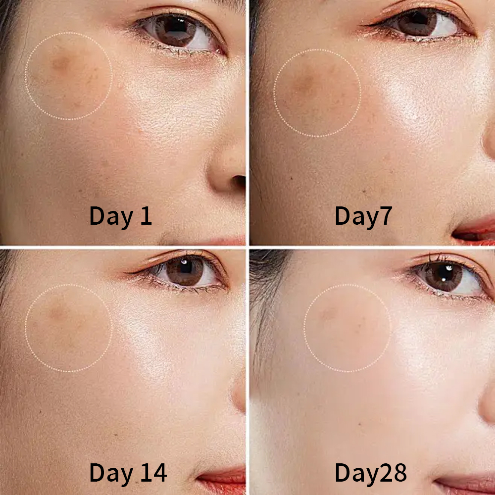 Glutathione Serum for Targeted Hyperpigmentation Care