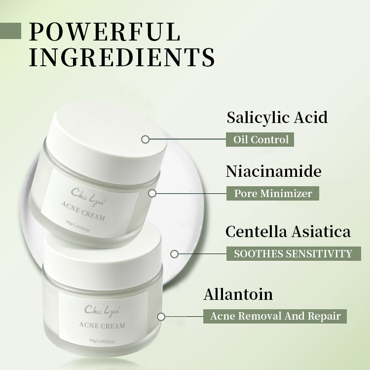 Salicylic Acid Acne Removing Face Cream for Students Acne Removing and Moisturizing Face Cream