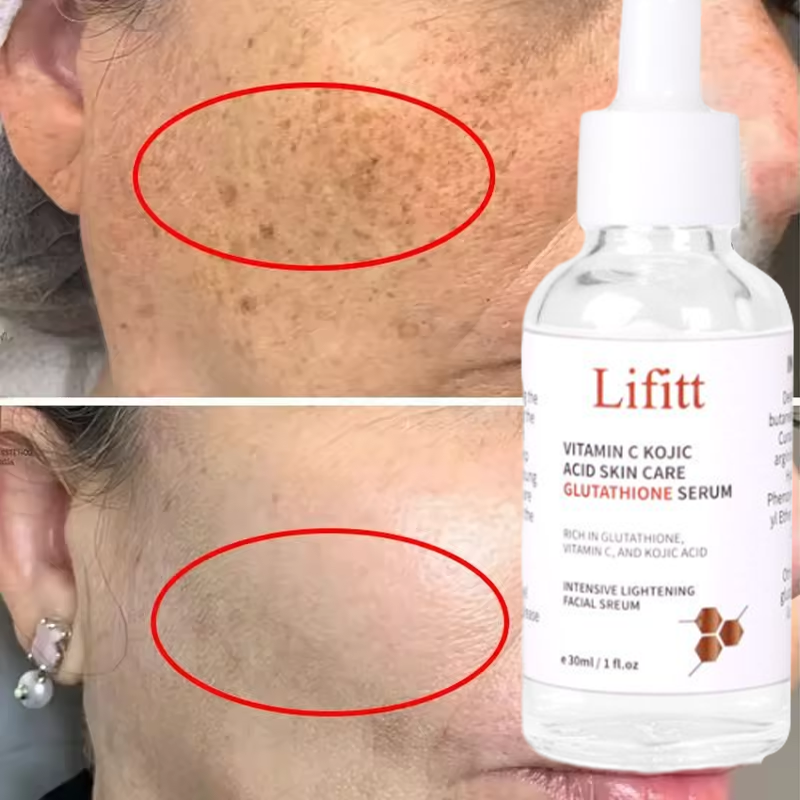 LIFITT Private Label Skin Care Serum Vitamin C Koji Acid Lighting Facial Serum Skin Freckle Brightening Serum