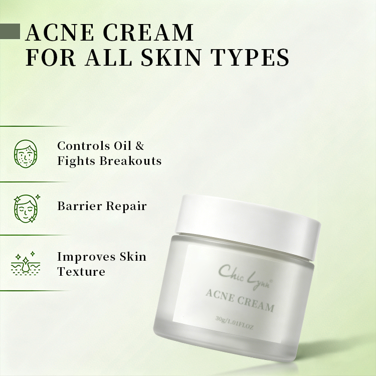 Salicylic Acid Acne Removing Face Cream for Students Acne Removing and Moisturizing Face Cream