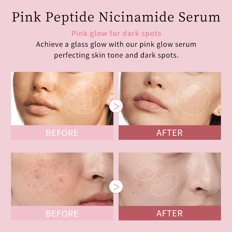Advanced Niacinamide Face Serum Tremella Fuciformis Anti-Aging Smoothing Firming Peptide Face Serum for US Markets Bulk