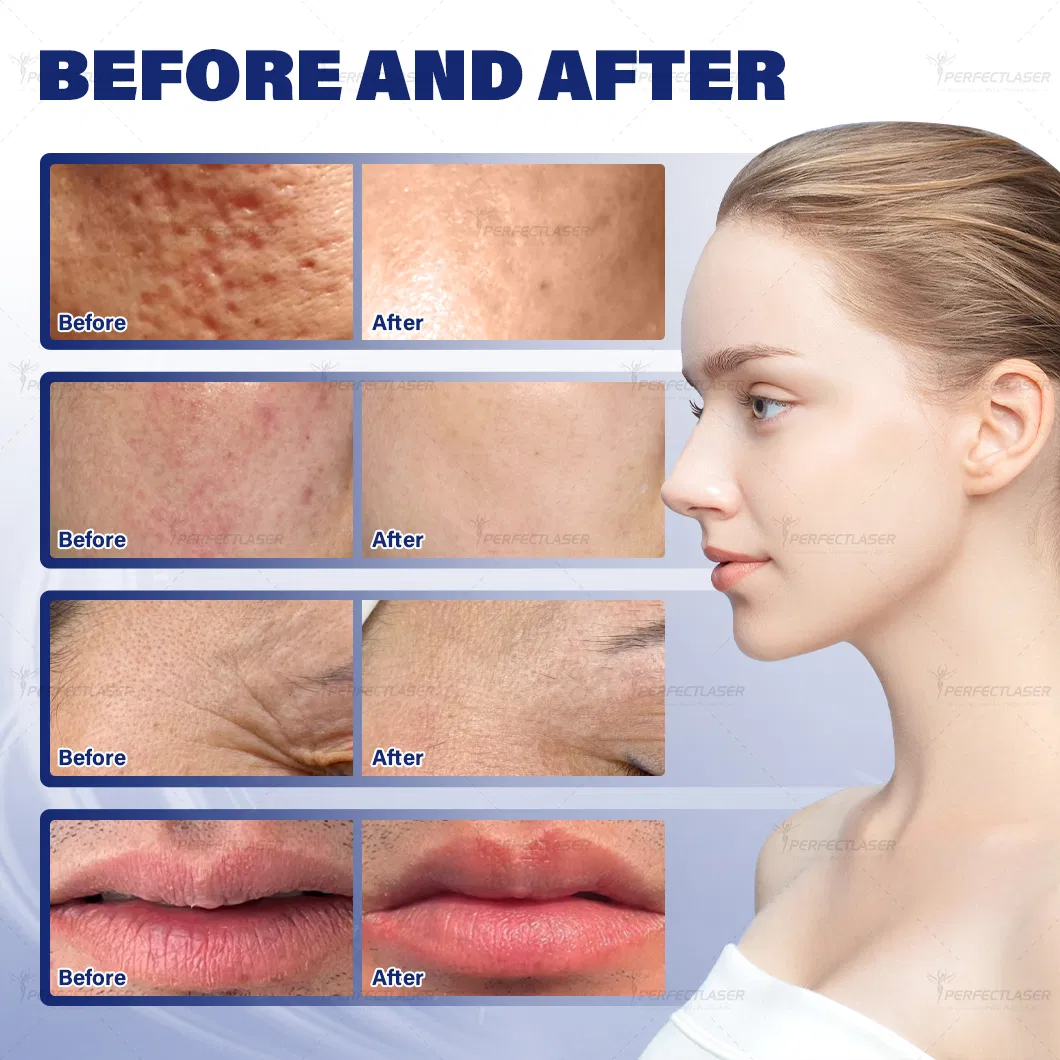 Before and After Results