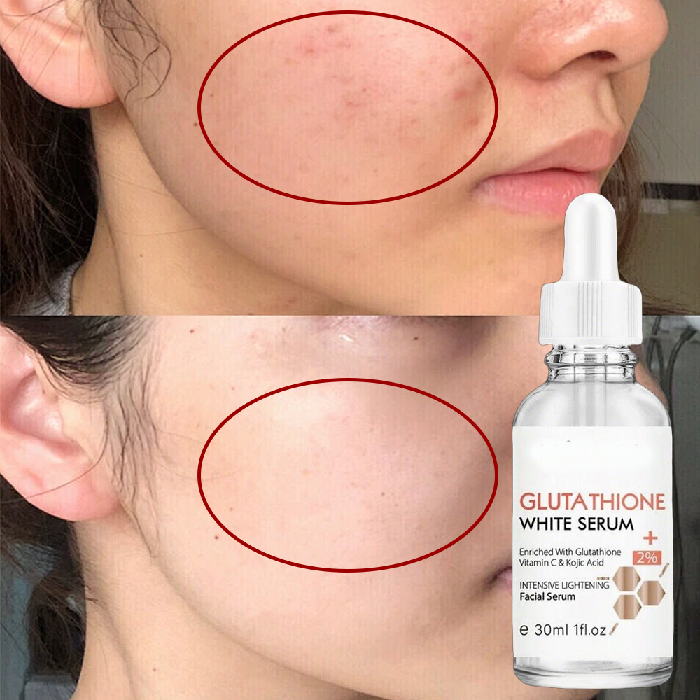 Glutathione Skin Lightening Serum for Hyperpigmentation