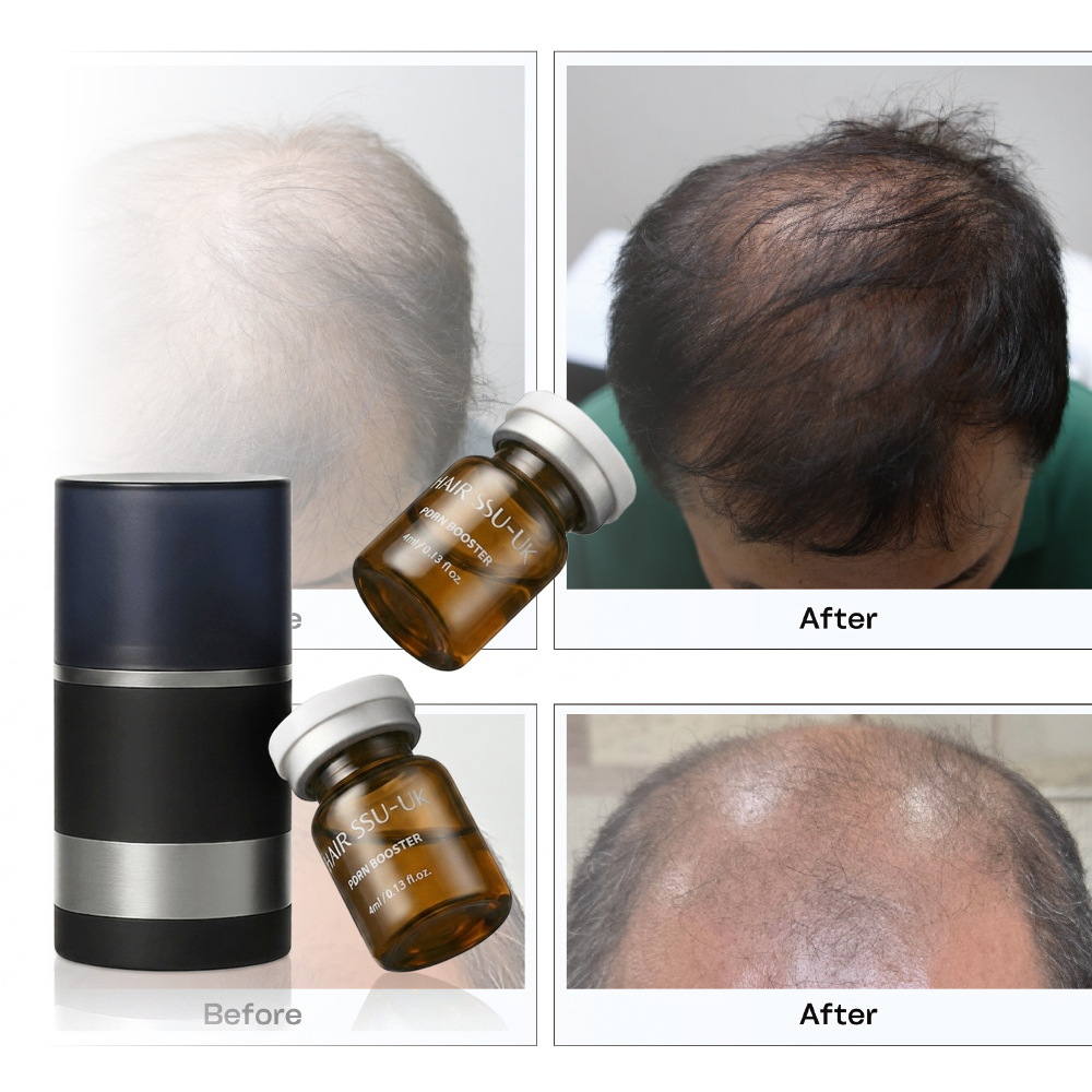 OEM PDRN Men Hair Booster Scalp Serum Anti Hair Loss Treatment Private Label Thinning Hair Growth Stimulating Solution Wholesale