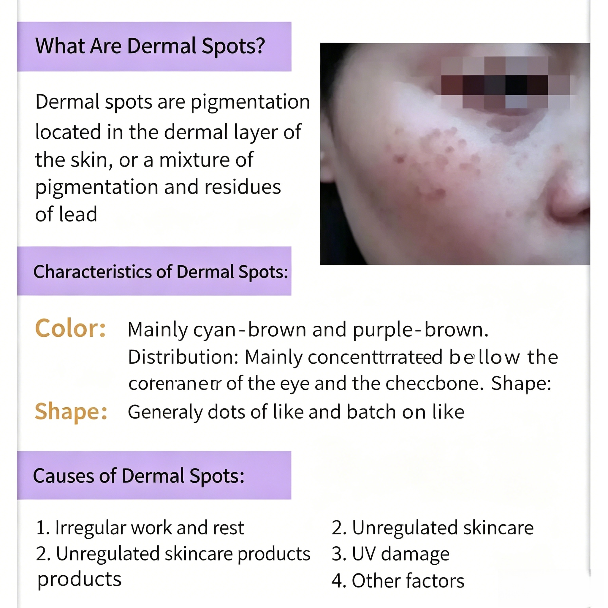 OEM Professional Stubborn Dermal Spot Fading Kit Deep Melasma Hyperpigmentation Peel Correction Remove Even Skin Tone Facial Set