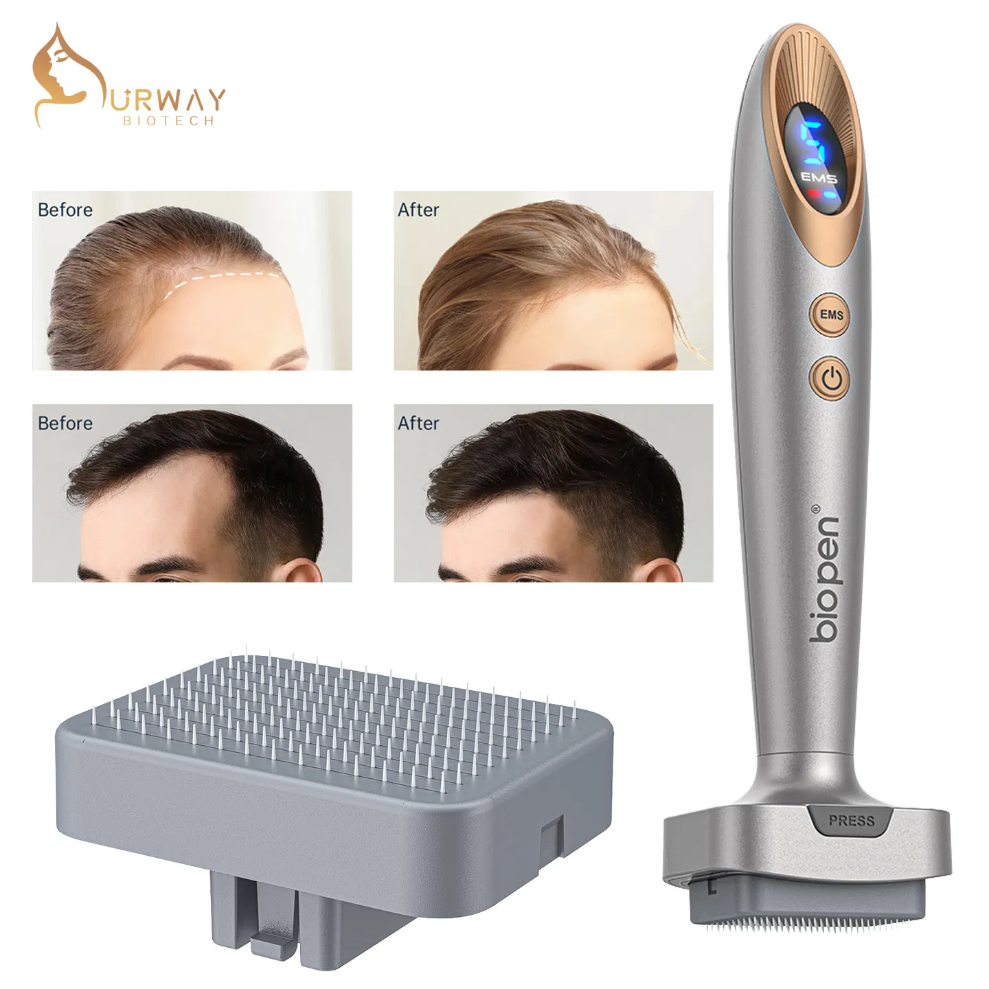 2026 New Electric Microneedle Facial Acne Removal, Anti-Aging, and Hair Growth