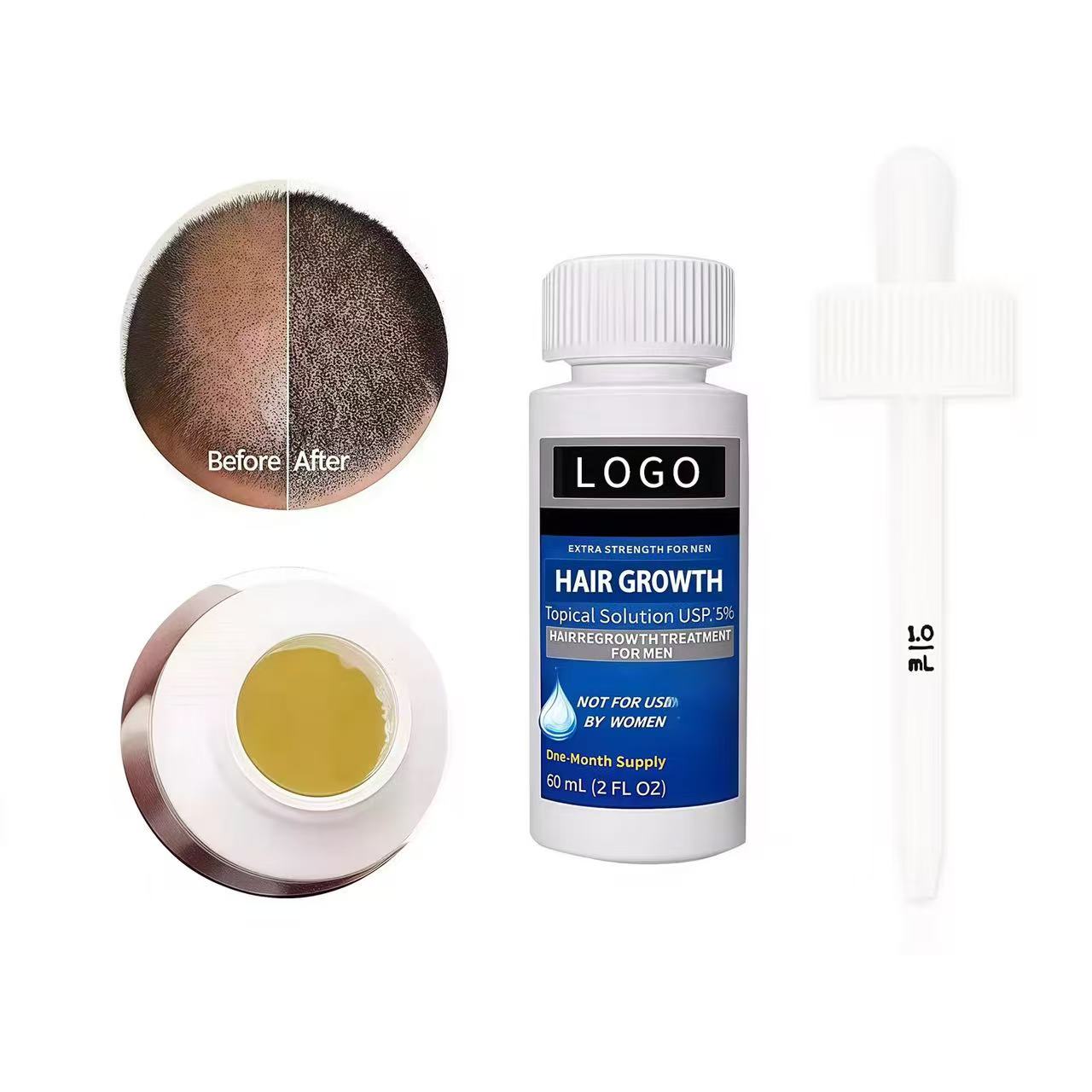 OEM Scalp Hair Root Liquid Hair Oil Thinning Dry Fine Hair Care Growth Follicle Repair Fall Control Serum 2-in-1 Formula Unisex