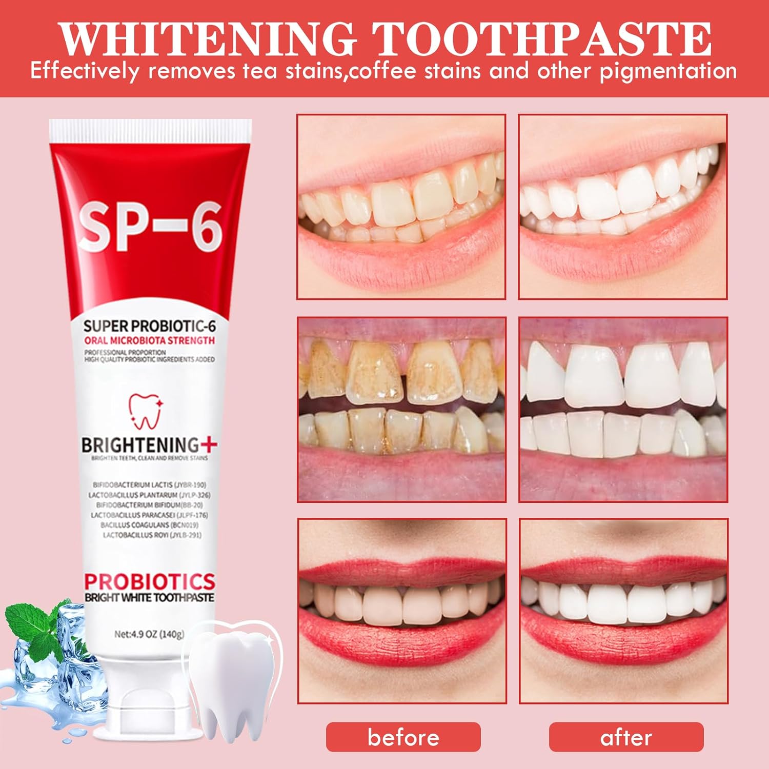 SP-6 Probiotic Brightening Chemical Toothpaste Oral Microbiome Strength Whitening for Bad Breath Stain Removal Fluoride Free