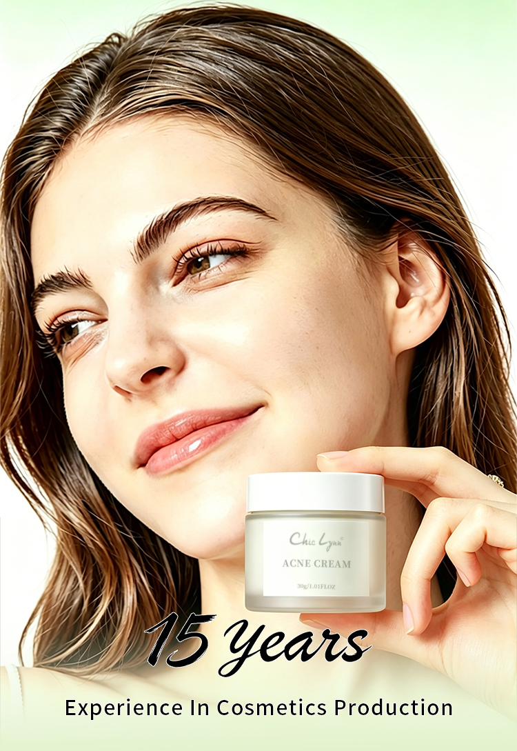 Salicylic Acid Acne Removing Face Cream for Students Acne Removing and Moisturizing Face Cream