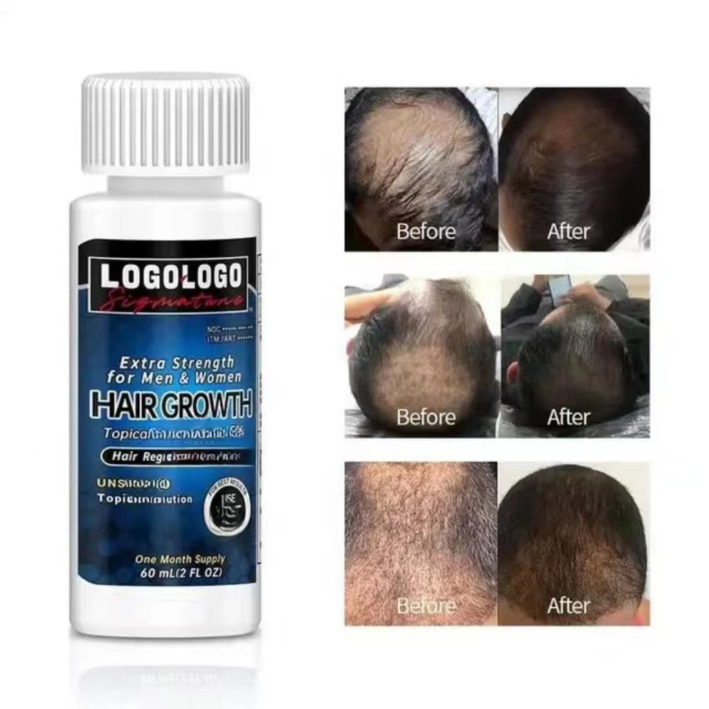 Hair Growth Hair Oil Serum Herbal Biotin Regrowth for Scalp Circulation Hair Treatment