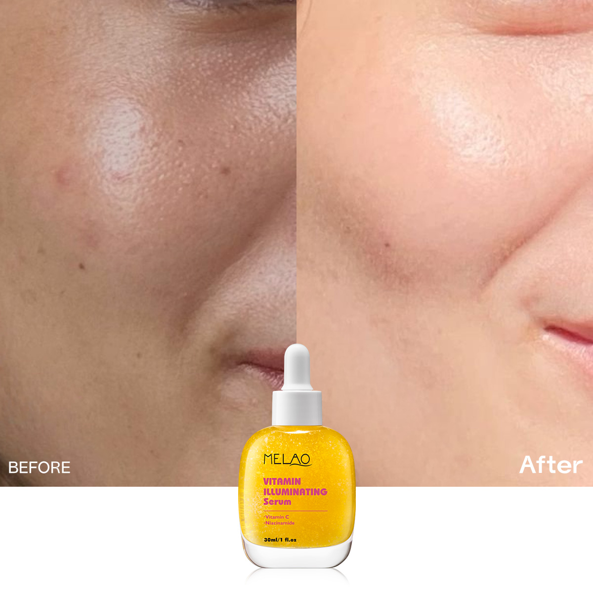 ODM Daily Radiance Essence Smooth Texture Glow Enhancing Moisture Lock Skin Renewal Antioxidant Repair Care 30ml Vitamin c Serum