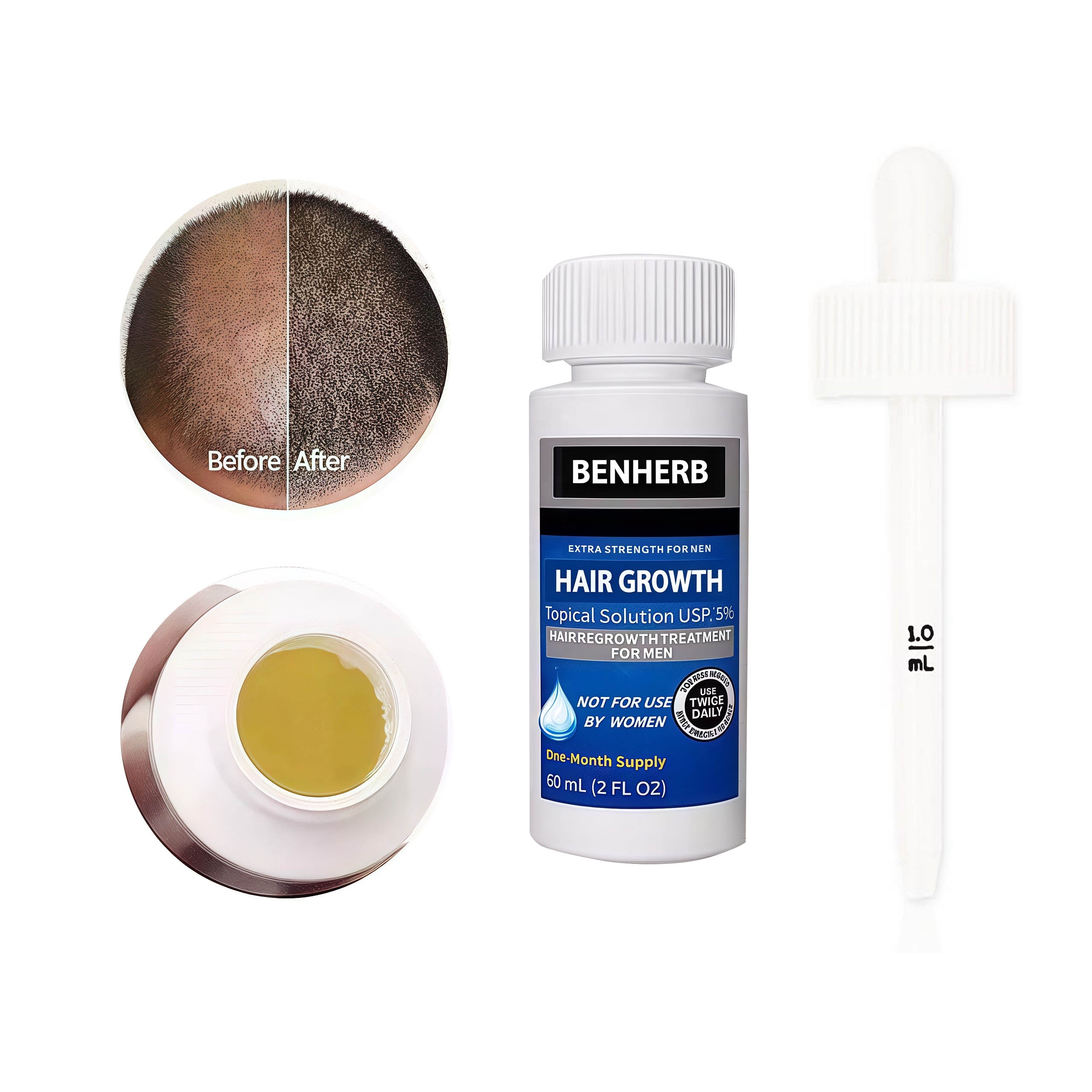 Private Label 5% Men's and Women's Hair Regeneration Essence - Clinical Strength Biotin Hair Loss Treatment - Scalp Growth Oil