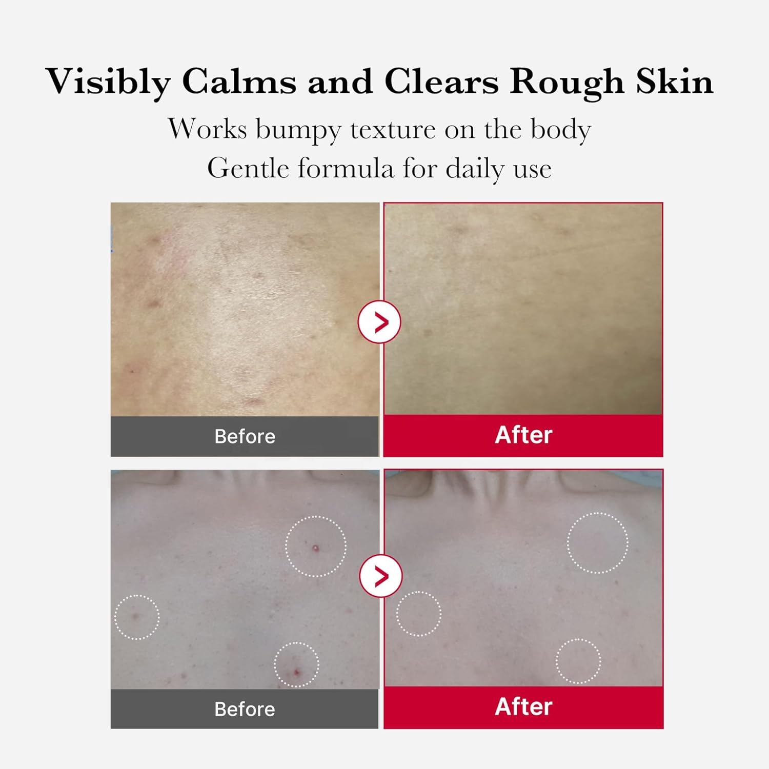 Medicube Red Body Peeling Shot 110g Korean Skin Care Body Care Products AHA + BHA Exfoliating Body Spray Pore Care