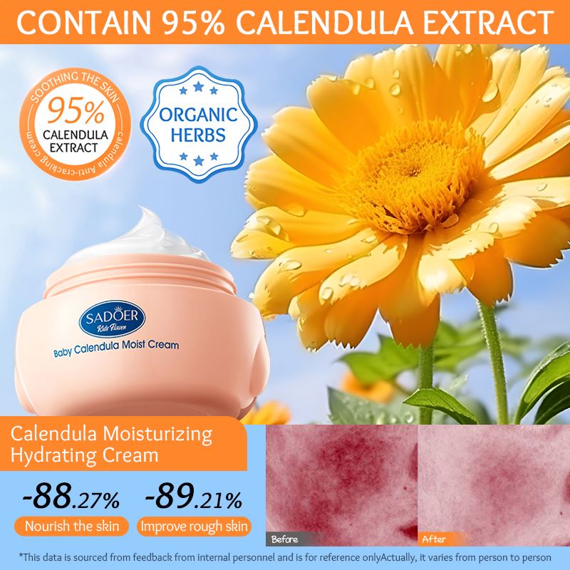 OEM SADOER Kids Moisturizer Cream Organic Calendula Gentle Hydrating Skin Care Sensitive Soothing Repair Baby Face Beauty Cream