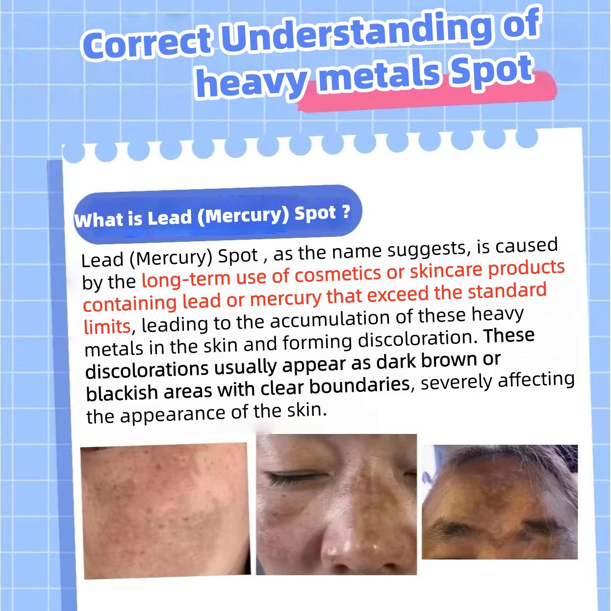 Hyperpigmentation Caused by Heavy Metals in Cosmetics 4 In1 Skin Blemish Melasma for Face Pigmentation Peel Remove Treatment Set