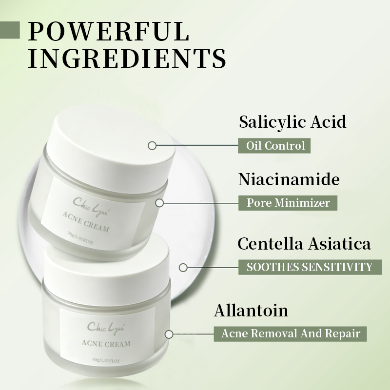 Salicylic Acid Acne Removing Face Cream For Students Acne Removing And Moisturizing Face Cream