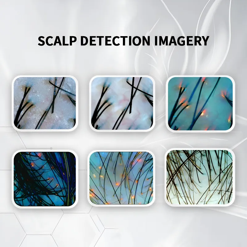 Professional Facial Ai 3D Skin Detector Diagnosis Face Scan Analyzer System Machine Device Skin Analysis
