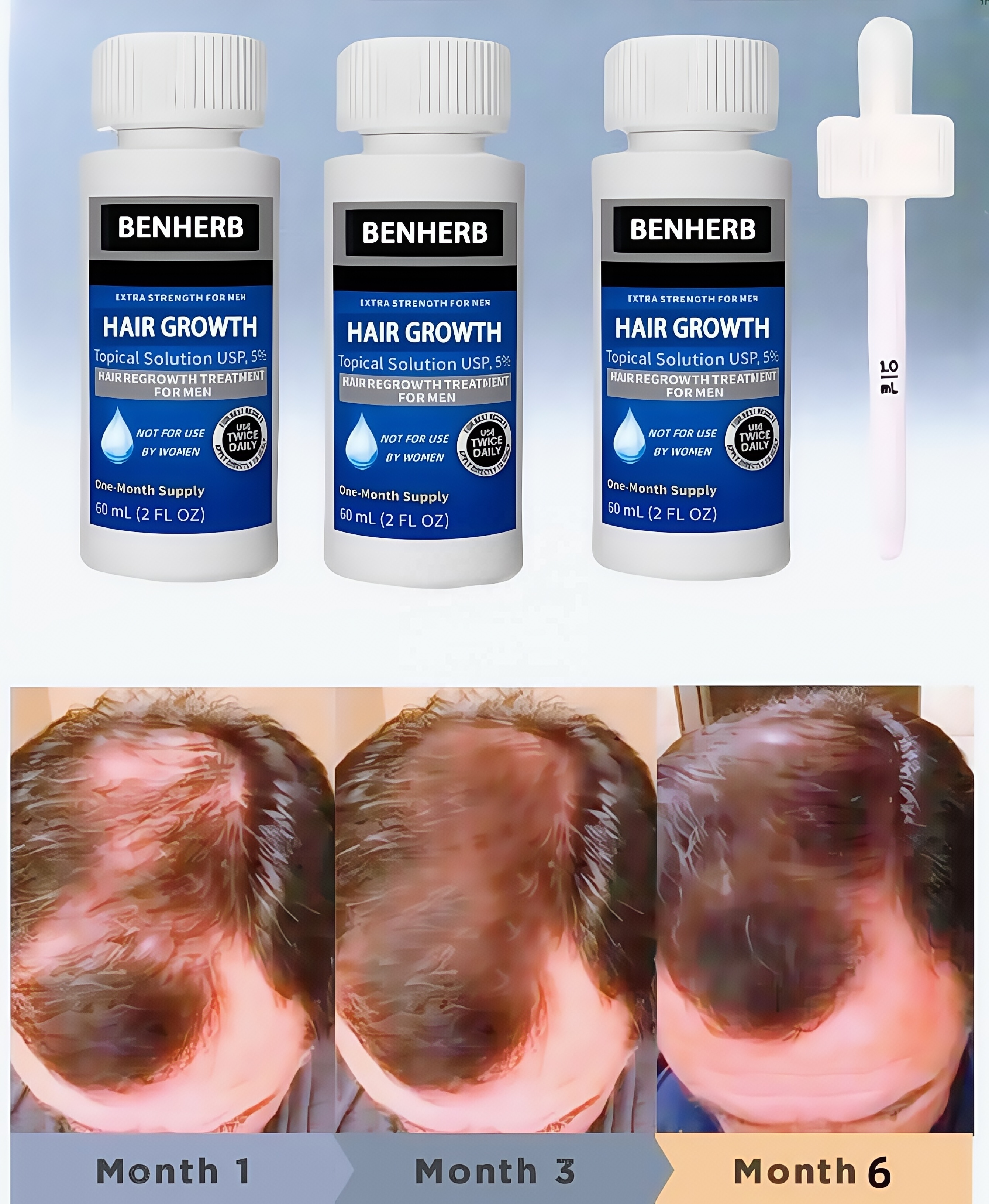 Private Label 5% Men's and Women's Hair Regeneration Essence - Clinical Strength Biotin Hair Loss Treatment - Scalp Growth Oil