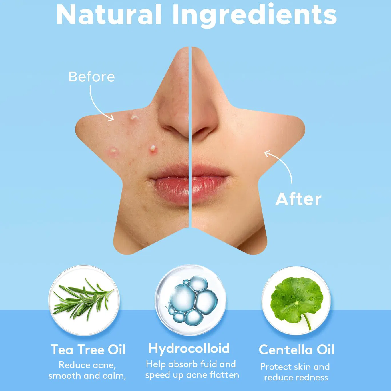 Pimple Patches Detail 3