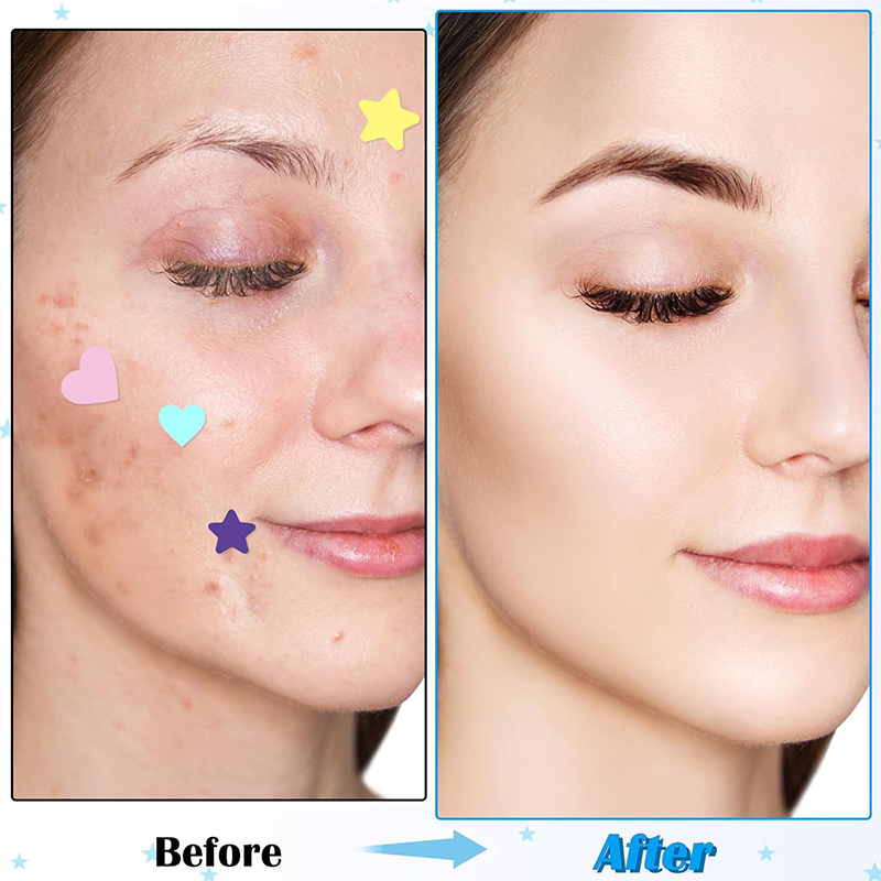 Yellow Iron Box Pimple Patches for Covering Zits Blemishes Spot Beauty Equipment
