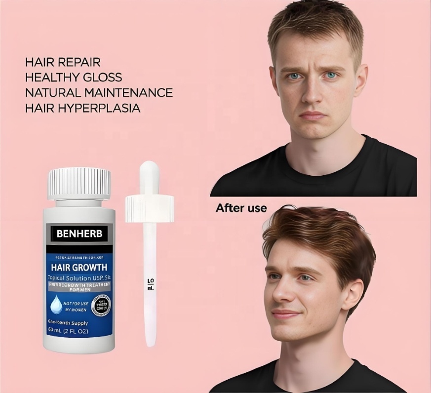 Private Label 5% Men's and Women's Hair Regeneration Essence - Clinical Strength Biotin Hair Loss Treatment - Scalp Growth Oil