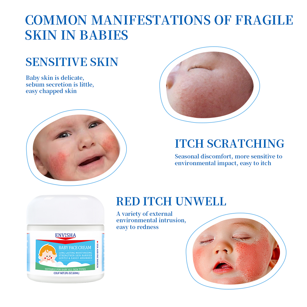 Baby Face Cream Gallery 3