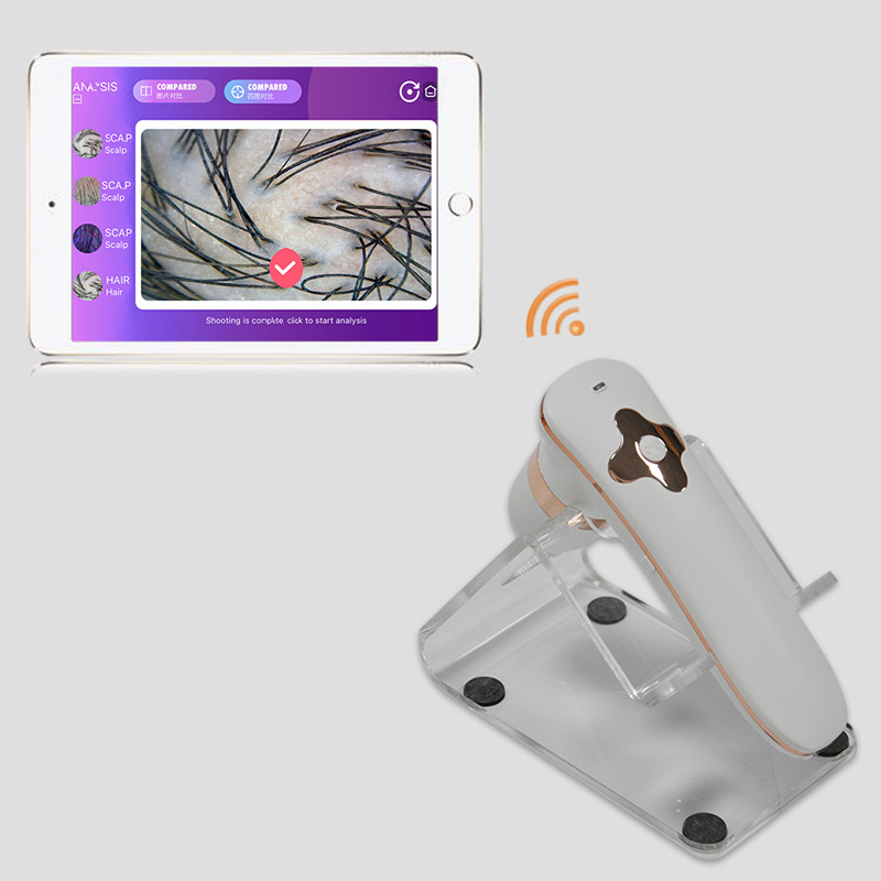 Handheld Scalp Analyzer For Hair Growth Treatment Tracking At Home