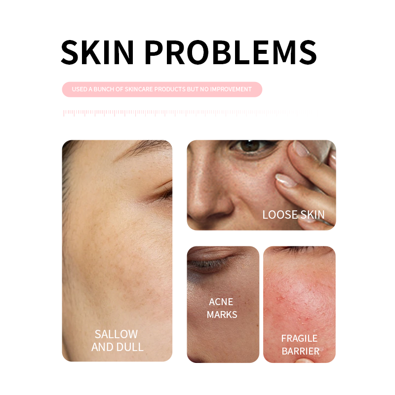 Private Label 10% Niacinamide Cream Face Moisturizer Dark Spots Corrector Hyperpigmentation Fading Brightening Age Defying OEM