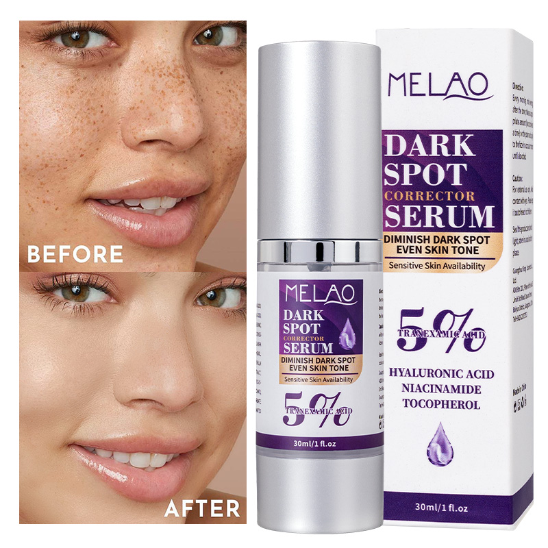 OEM Face Serum Skin Care Dark Spot Correct Hyperpigmentation Whitening Serum
