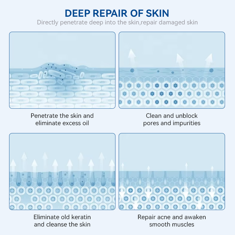 Fast Effective Repair Pimple Scar Anti Spots Removal Gel Smooth Salicylic Acid Skin Shrink Pores Acne Face Cream