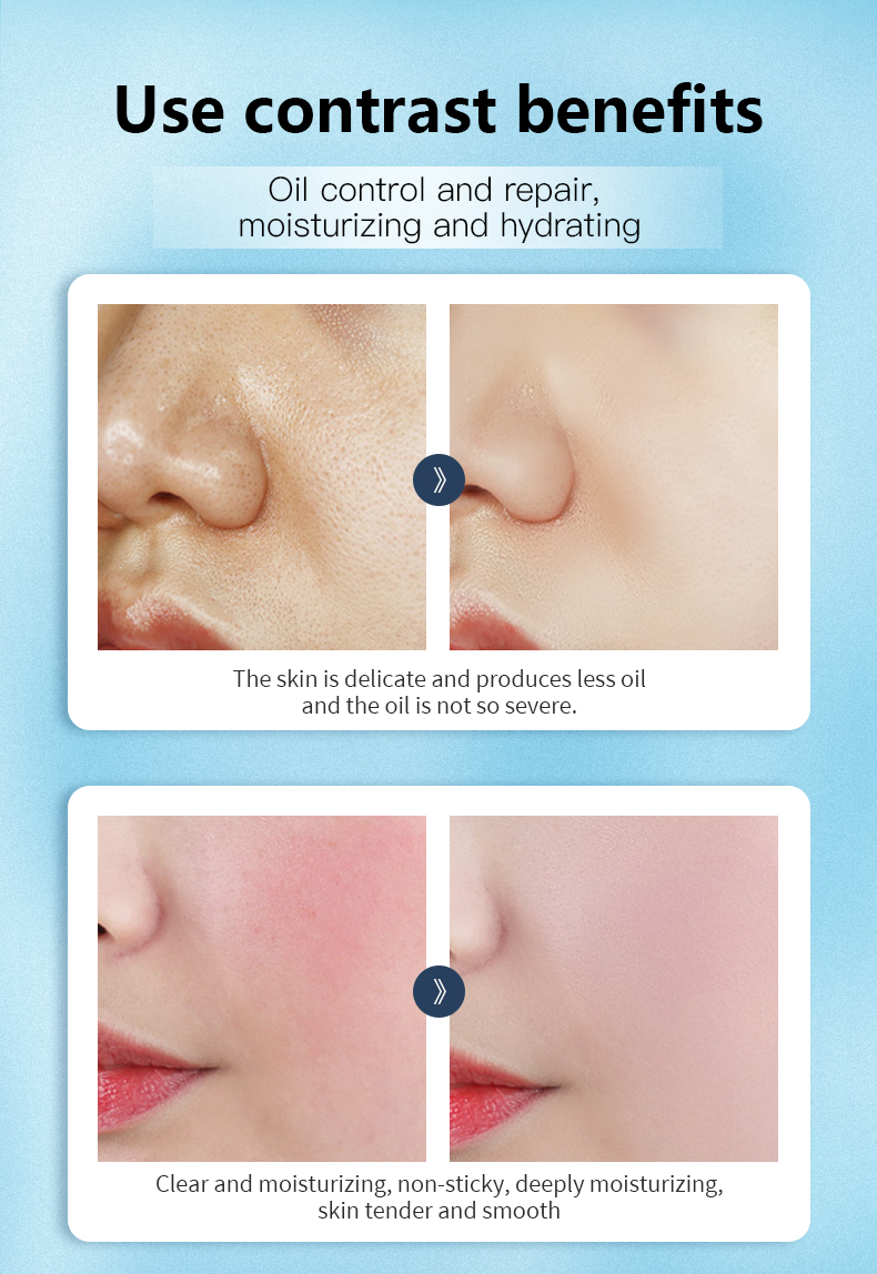 Private Label Salicylic Acid Collagen Skin Care Kit Moisturizing Korean Cosmetic Essence, Water, Cream, Essence Skin Care Set