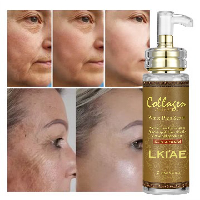 Oem Hyperpigmentation Traitement Bleaching Moisturizer Skin Care Facial 20% Vitamin C Whitening Beauty Serum for Face