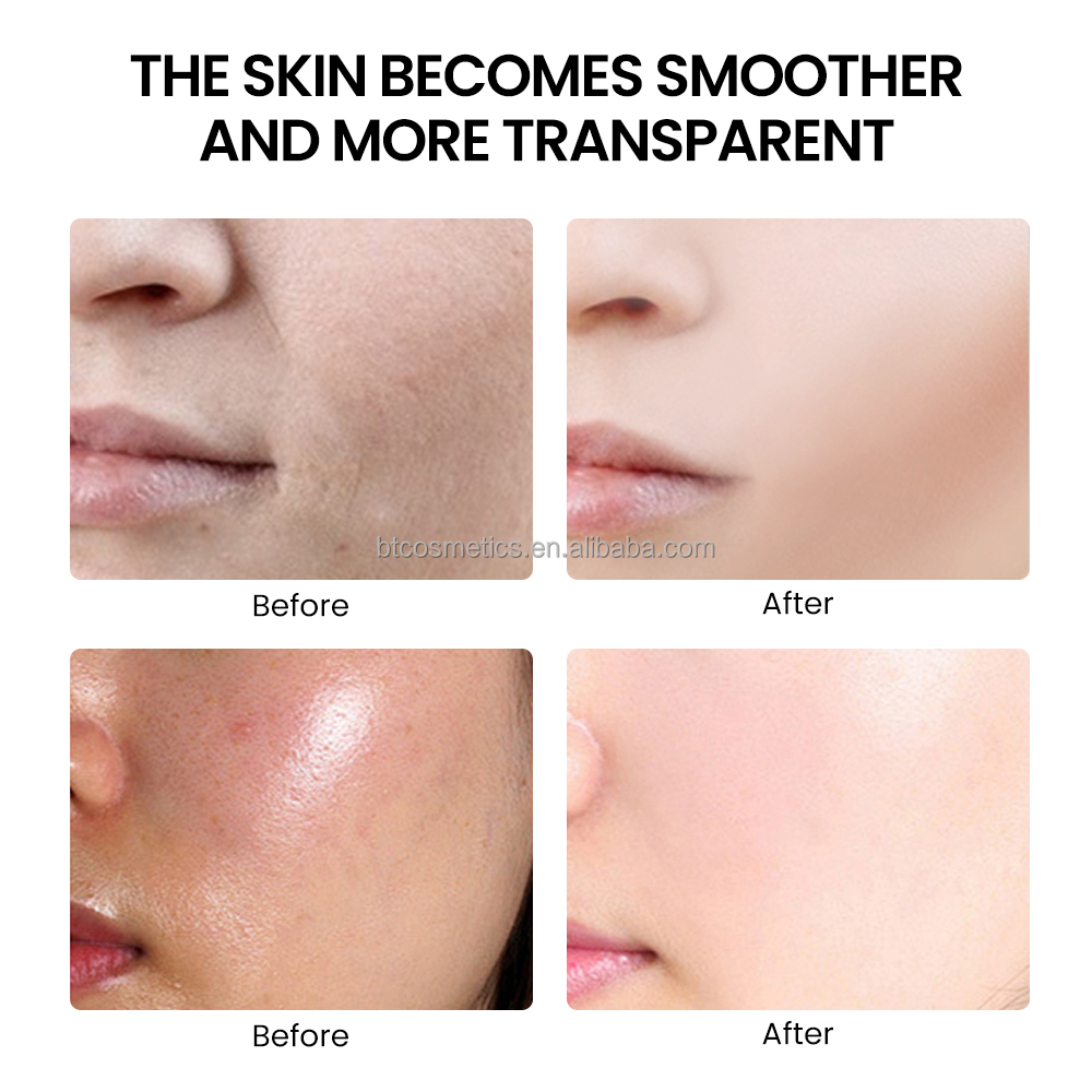 High Content Active Ingredients Custom Brand 9Essence Facial Serum Whitening Anti-Aging Moisturizing Set with Bottle