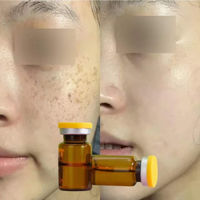 Brightening Skin Rejuvenating Serum Whitening Ampoule for Skin Depigmentation Solution Hyperpigmentation Dark Spot Remover Serum