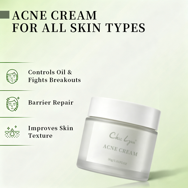 Salicylic Acid Acne Removing Face Cream For Students Acne Removing And Moisturizing Face Cream