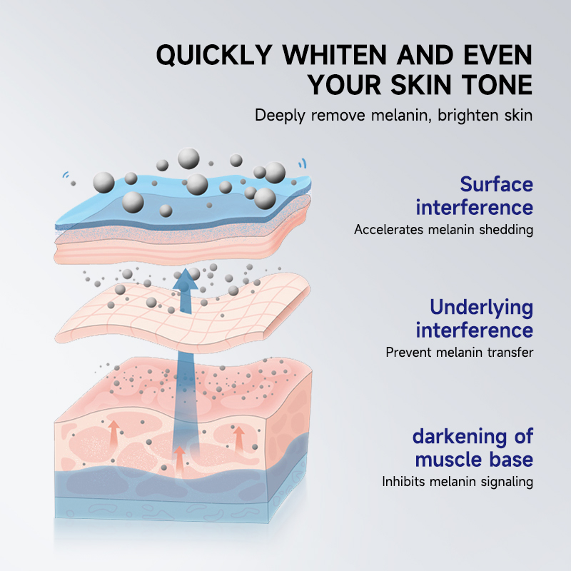 Wholesale Ready to Ship Intense Whitening Cream 50g Private Label OEM ODM Manufacturer Hyperpigmentation Dark Spot Corrector