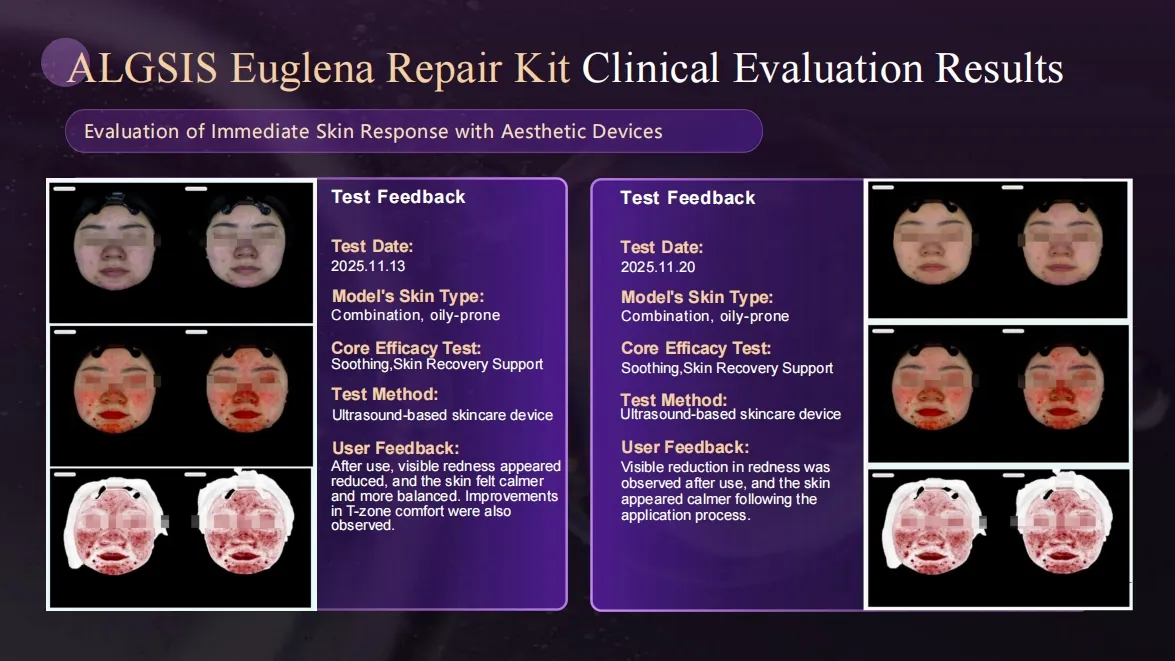 Euglena Microneedle Exosome Kit 6
