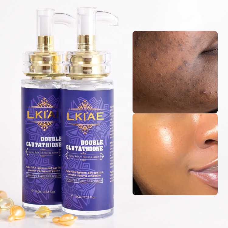 Oem Hyperpigmentation Traitement Bleaching Moisturizer Skin Care Facial 20% Vitamin C Whitening Beauty Serum for Face