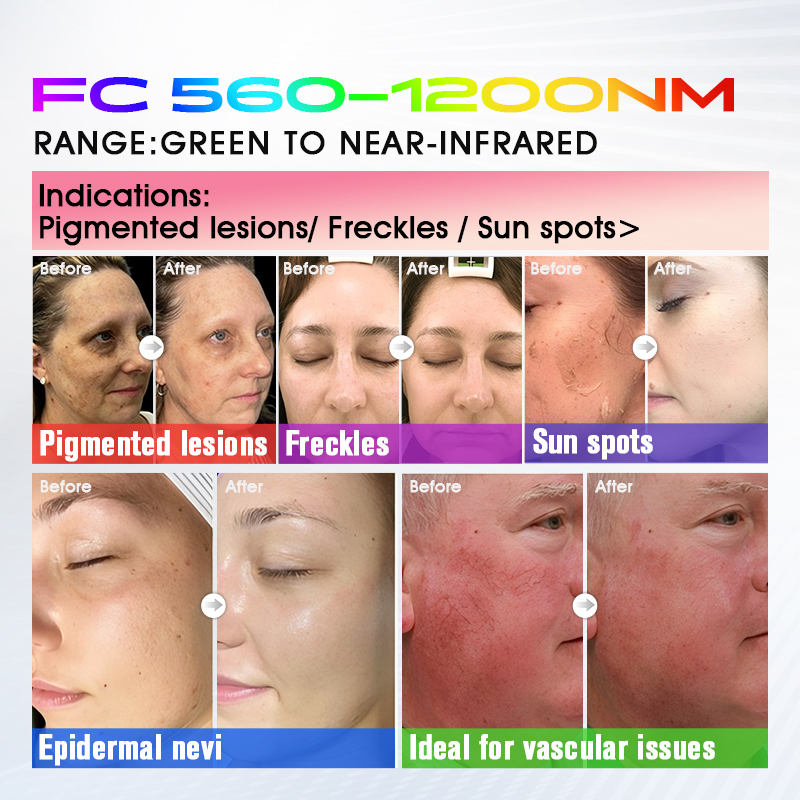 FC 560-1200nm skin result