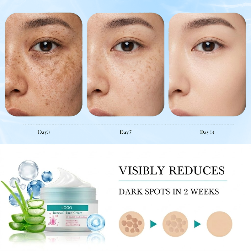 Skin Renewal Brightening Cream Dark Spot Remover Hyperpigmentation Treatment Cell Regeneration Firming Lifting Face Moisturizer
