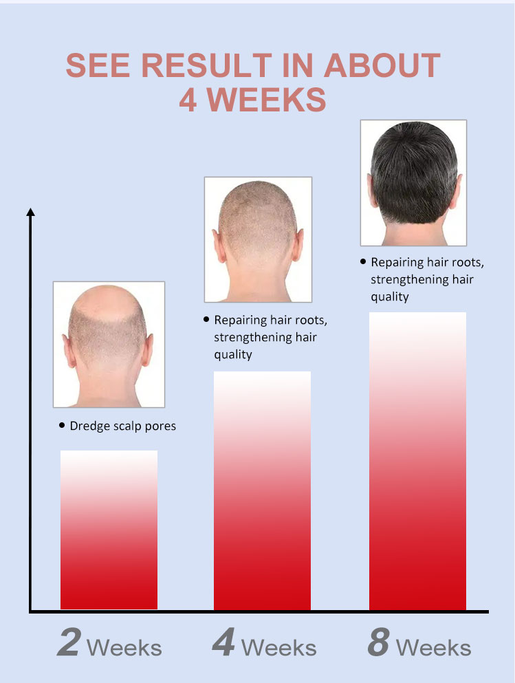 Scalp Care Treatment