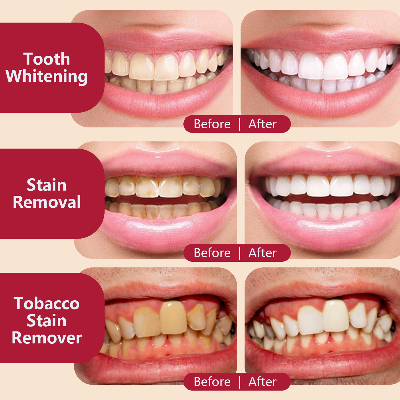 Probiotic Whitening Toothpaste Oral Microbiome Balance Stain Removal Fresh Breath Private Label