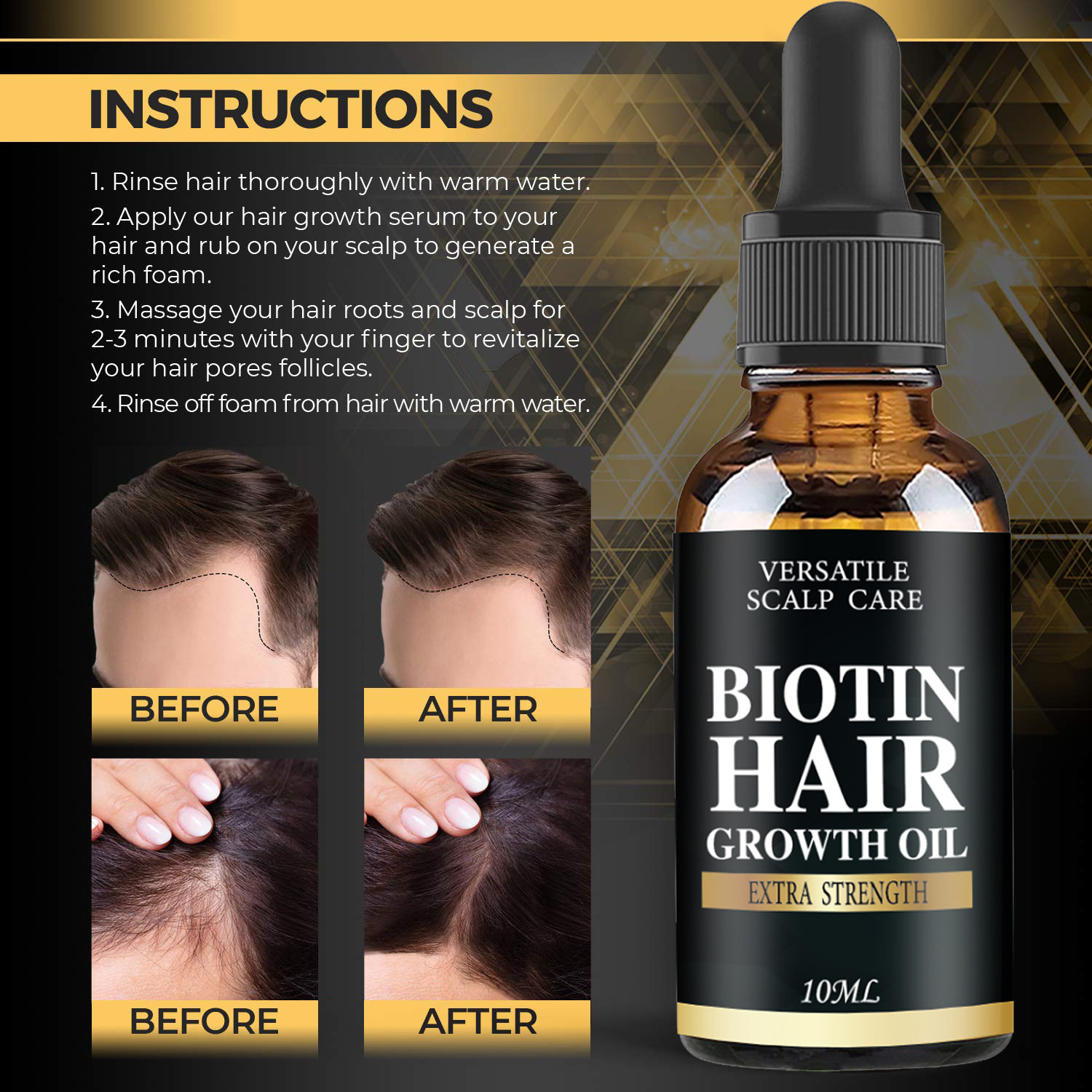 Private Label Wholesale Nourishing Scalp Elixirs Hair Care Treatment Biotin Hair Growth Oil Serum Anti Hair Loss
