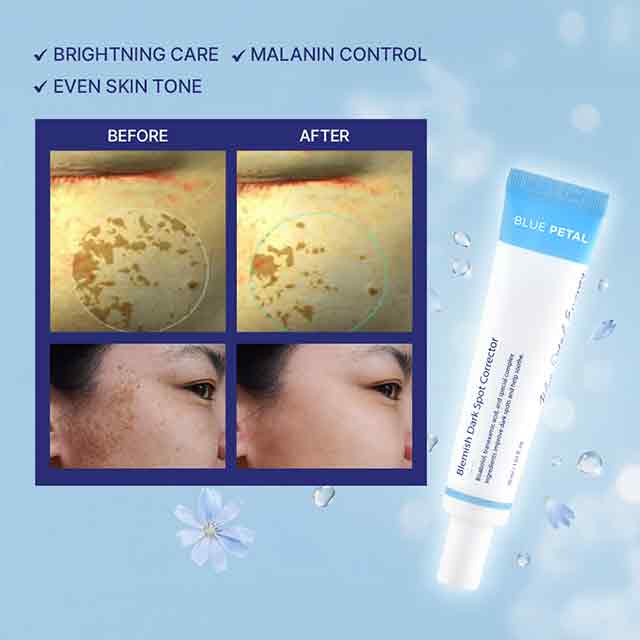 Blue Petal Dark Spot Corrector Brightening Serum Hyperpigmentation Tone Up Solution Melanin Care Uneven Skin Tone Radiance Boost