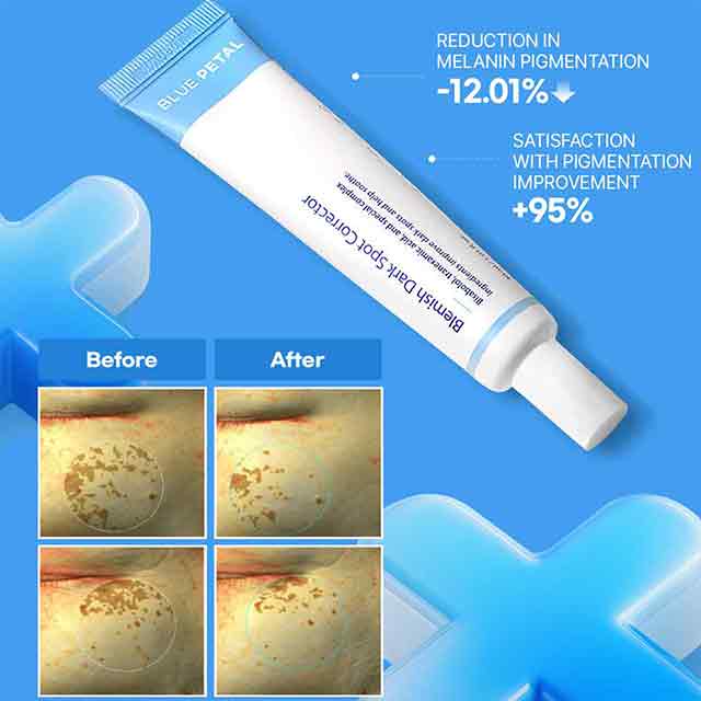 Blue Petal Dark Spot Corrector Brightening Serum Hyperpigmentation Tone Up Solution Melanin Care Uneven Skin Tone Radiance Boost