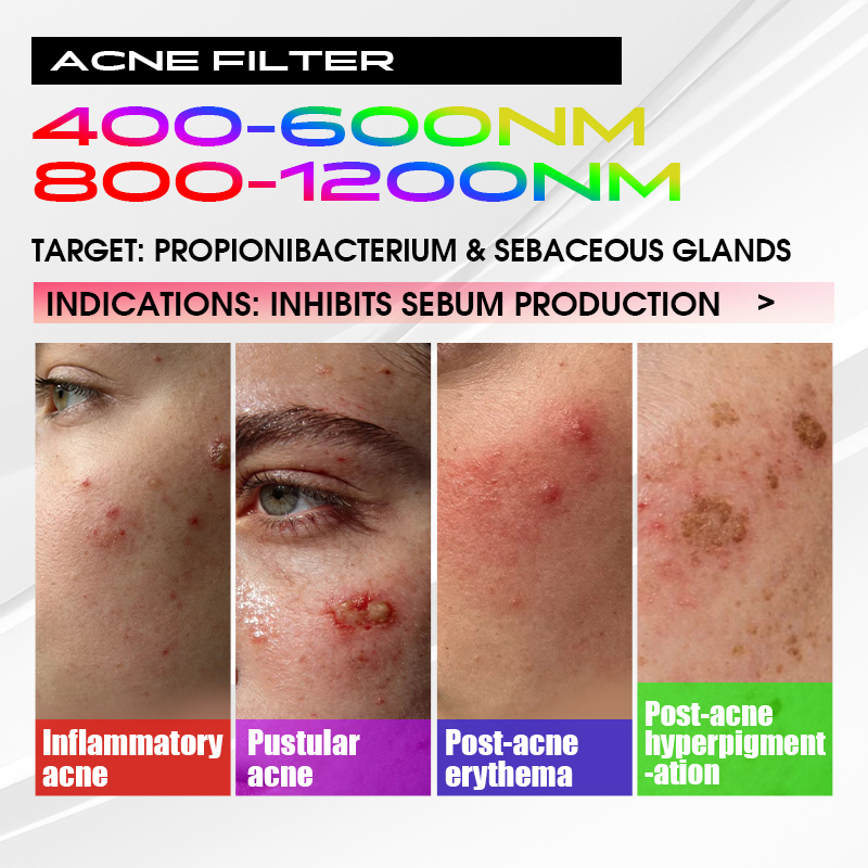 Acne Filter spectrum